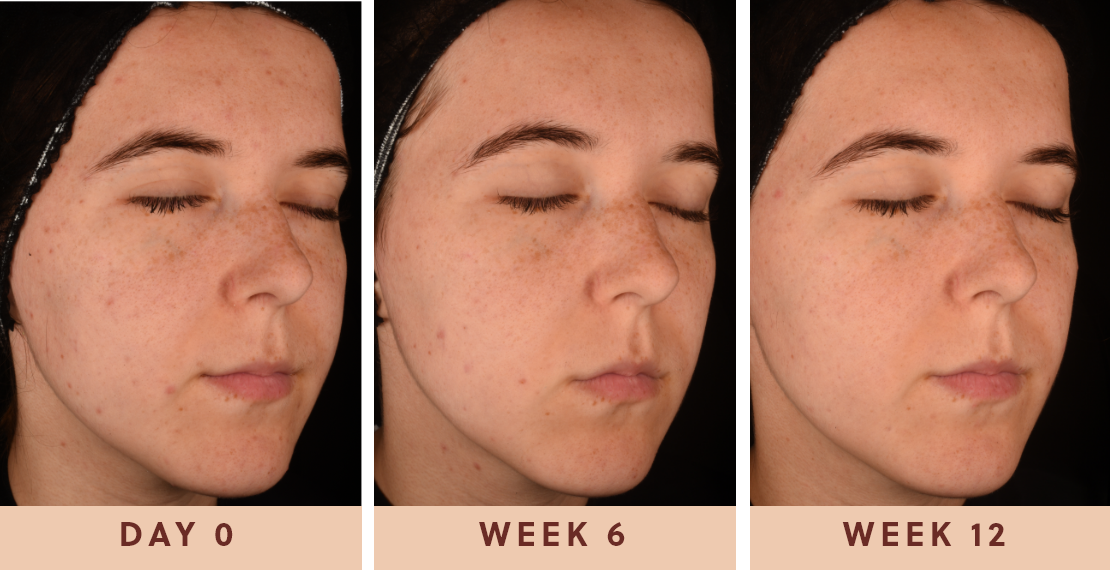 Image of woman displaying their results after using Glow Biome for 12 weeks