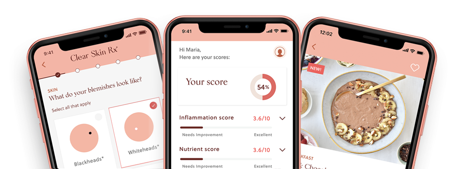 Here's How The App Works