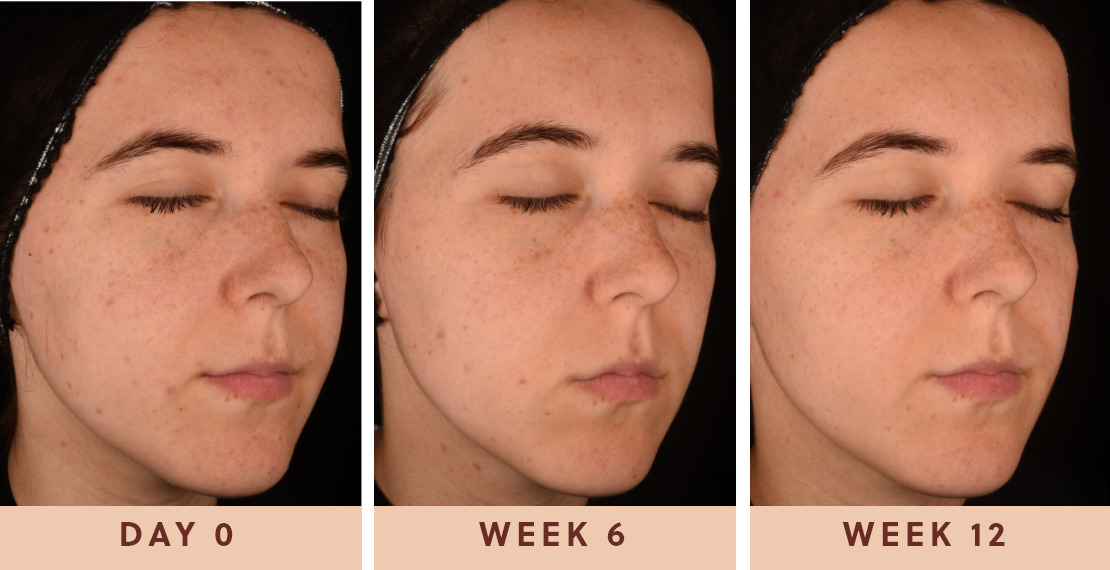 Image of woman displaying their results after using Glow Biome for 12 weeks				